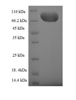 Guanine nucleotide-binding protein-like 3-like protein (GNL3L), human, recombinant