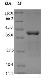 5'-AMP-activated protein kinase subunit gamma-2 (PRKAG2), human, recombinant
