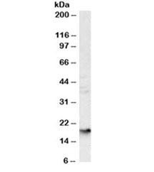 Anti-Glycophorin A