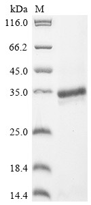 Endothelin-1 (Edn1), partial, rat, recombinant