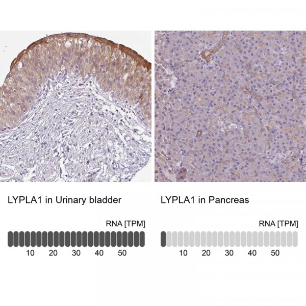 Anti-LYPLA1