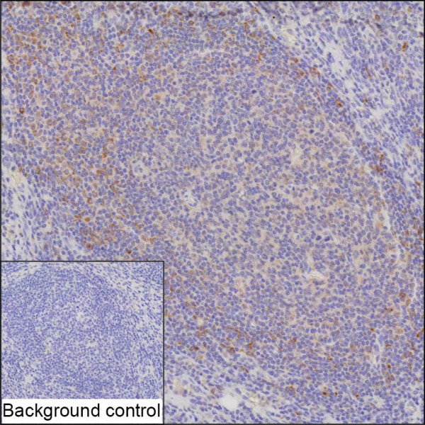 Anti-PTPN1