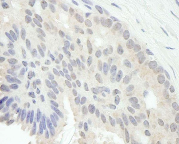 Anti-E2F1 (IHC)