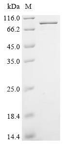 Serine/threonine-protein kinase RIO1 (RIOK1), human, recombinant