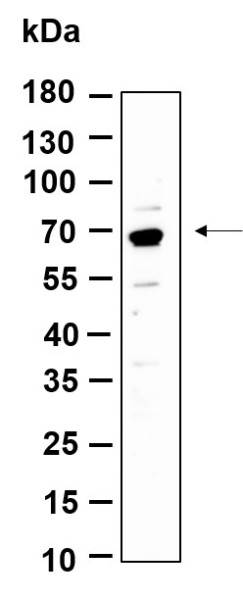 Anti-Recombinant Phospho-p70 S6 Kinase (Thr389), clone 11A4