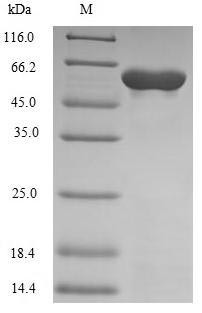 DNA-directed DNA/RNA polymerase mu (POLM), human, recombinant