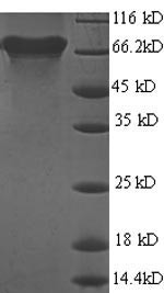 Urease subunit beta (ureB), Helicobacter pylori, recombinant