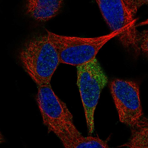 Anti-TP53INP1
