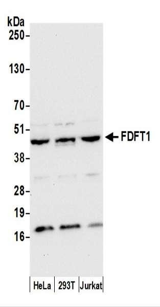 Anti-FDFT1