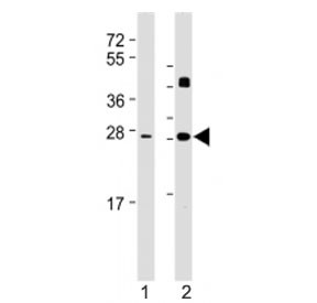 Anti-DKK2, clone 1833CT856.7.20