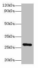Anti-Fgf23