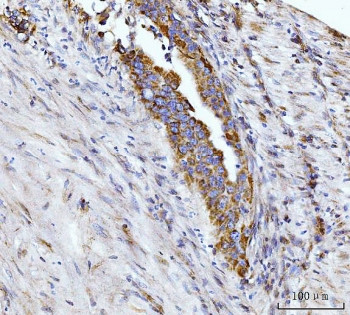 Anti-Glutaminase / GLS