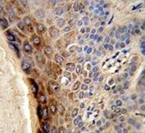 Anti-CTHRC1