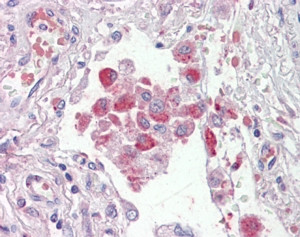 Anti-ORP9 / OSBPL9, C-terminal