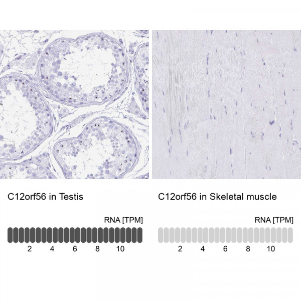 Anti-C12orf56