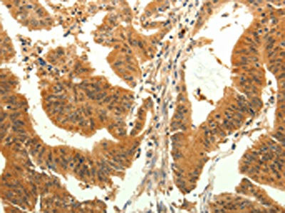 Anti-TRPM7