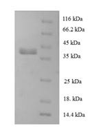 60S ribosomal protein L28 (RPL28), human, recombinant