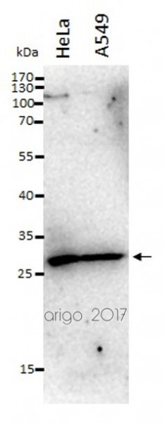 Anti-Snail homolog 1 / SNAI1, N-terminal