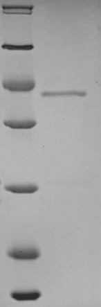 Sodium/calcium exchanger 1 (SLC8A1), partial, human, recombinant