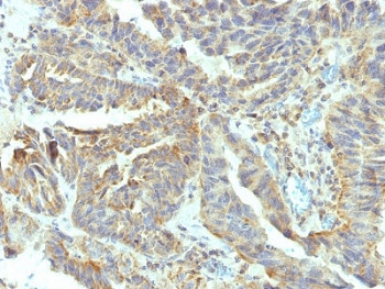 Anti-Alkaline Phosphatase / ALPL (tissue-nonspecific), clone V17.1