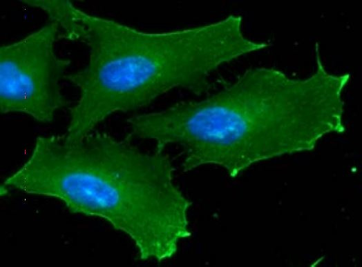 Anti-GSK3 Beta, clone 1F7