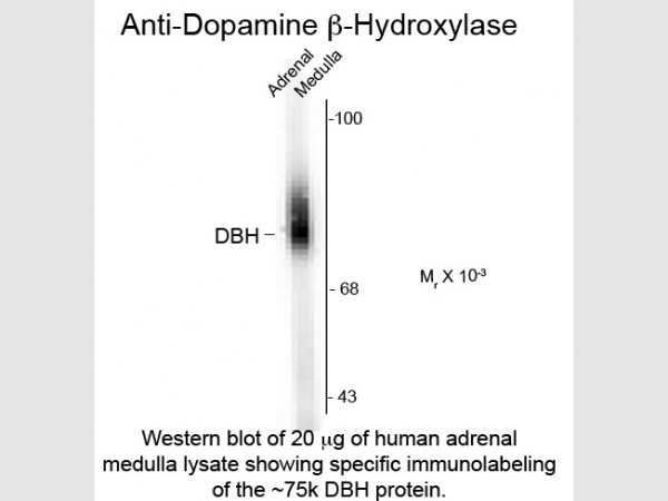 Anti-Dopamine ß-Hydroxylase