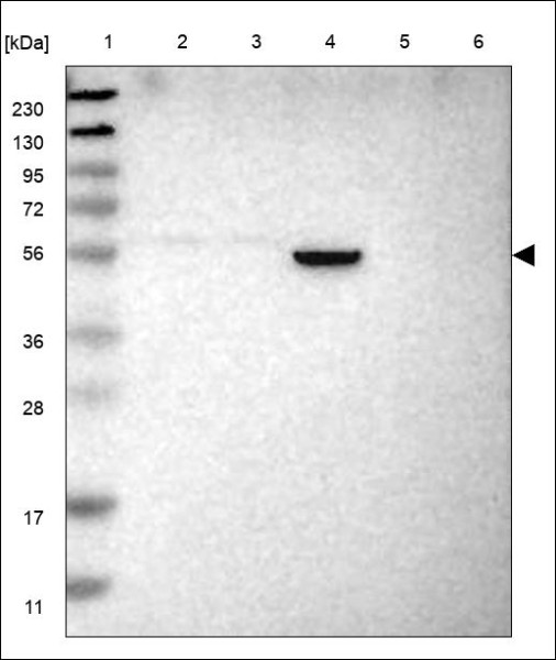 Anti-ZNF559