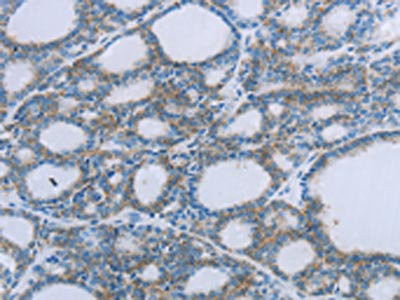 Anti-EGFL7