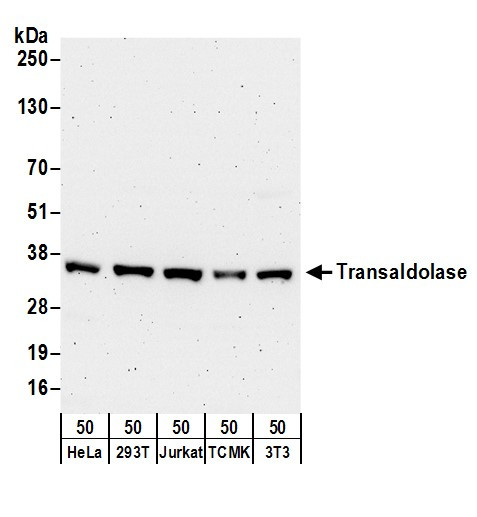 Anti-Transaldolase