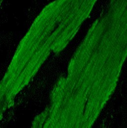 Anti-Troponin I (cardiac)