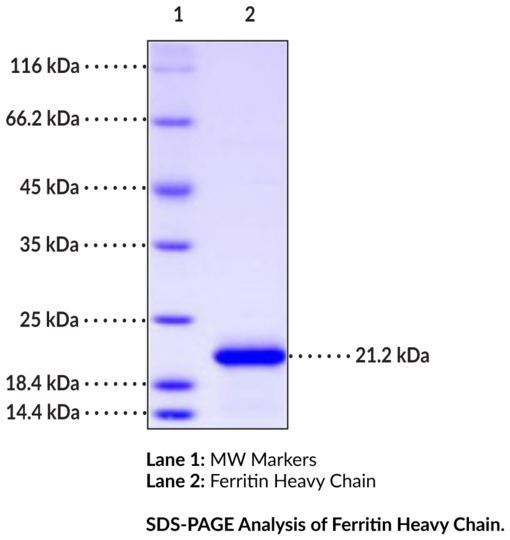 Ferritin Heavy Chain (human, recombinant)
