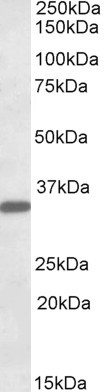 Anti-FGL1 / Hepassocin, Internal