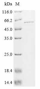 Serine/threonine-protein phosphatase 2A regulatory subunit B' subunit gamma (PPP2R3C), human, recomb