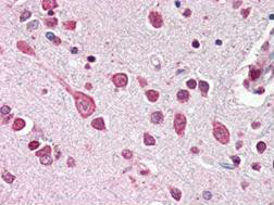 Anti-Cullin-7, CT (CUL-7)