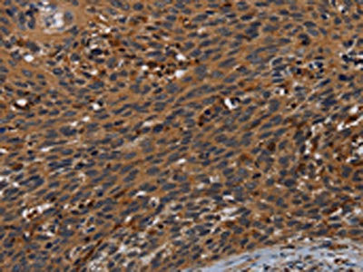 Anti-PCDHB15