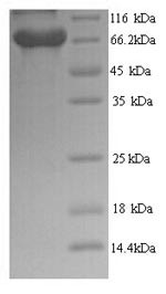 BRCA1-associated protein (BRAP), human, recombinant