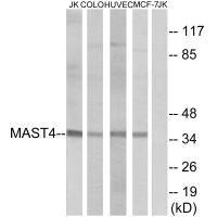 Anti-MAST4