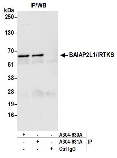 Anti-BAIAP2L1/IRTKS
