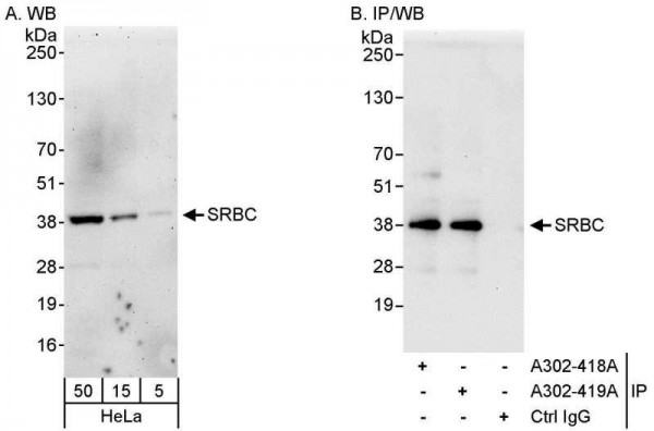 Anti-SRBC