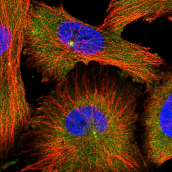 Anti-MDH1