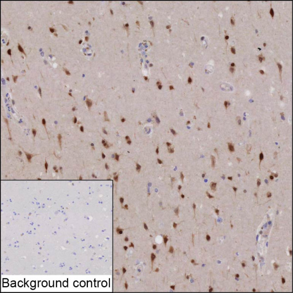 Anti-ELAVL3