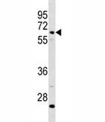 Anti-C8B