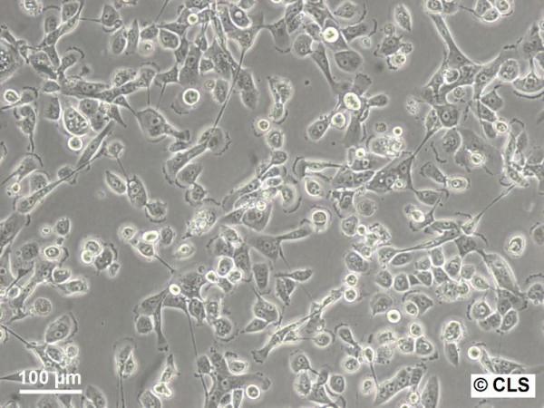 RCC-GS Cells
