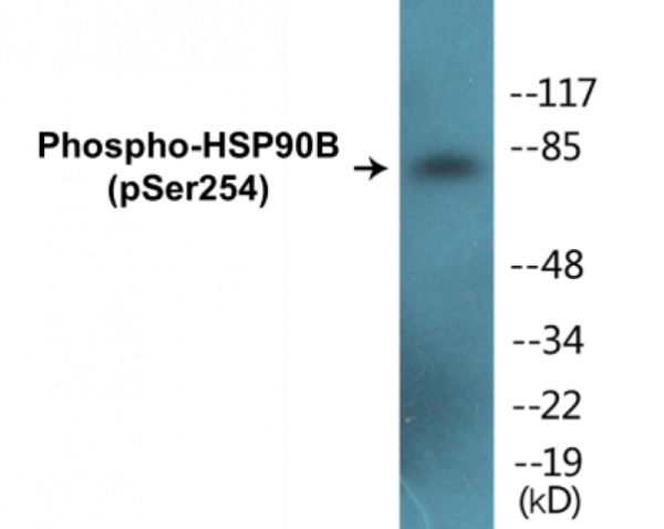 HSP90B (Phospho-Ser254) Colorimetric Cell-Based ELISA Kit