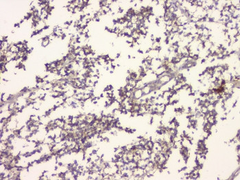 Anti-Amyloid beta / APP