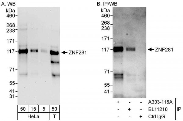 Anti-ZNF281