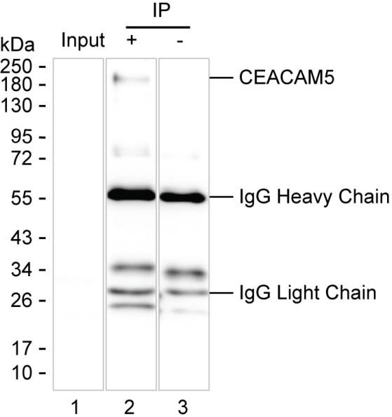 Anti-CEACAM5