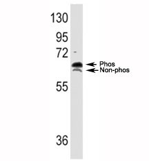 Anti-p70 S6 Kinase alpha (RPS6KB1)