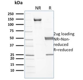 Anti-SPTB / Spectrin beta, clone RG/26