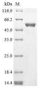 Trimethylamine-N-oxide reductase 1 (torA), partial, Escherichia coli O157:H7, recombinant